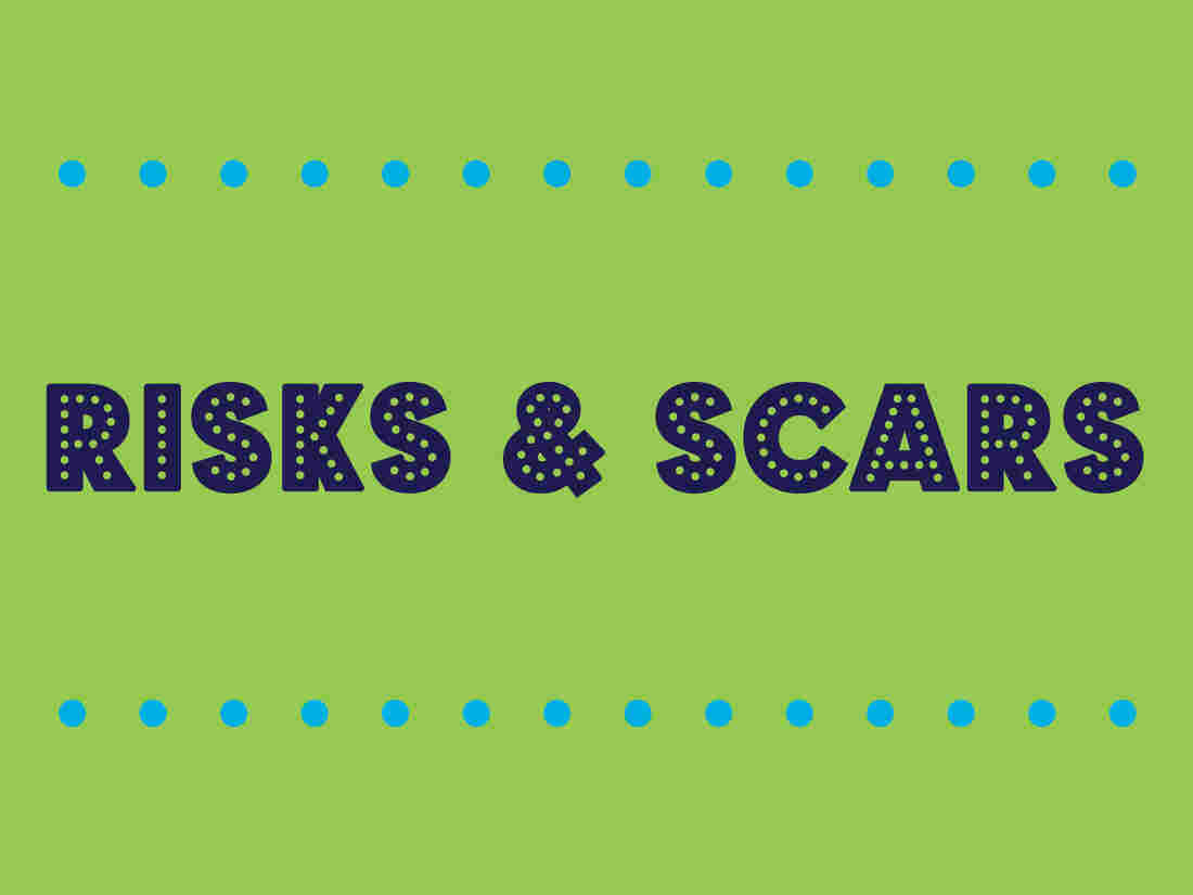 risks