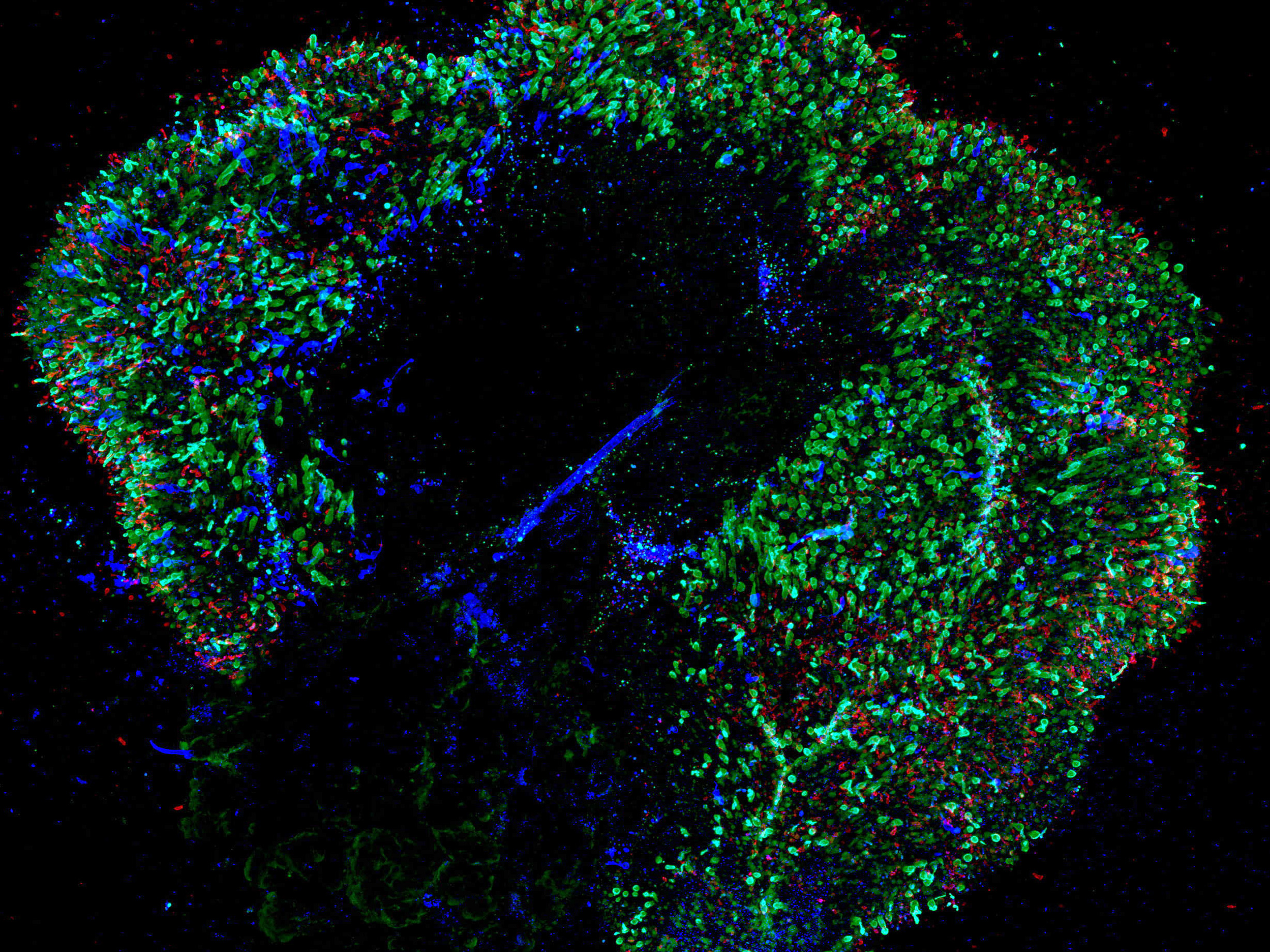 Human Retinas Grown In A Dish Reveal Origin Of Color Vision