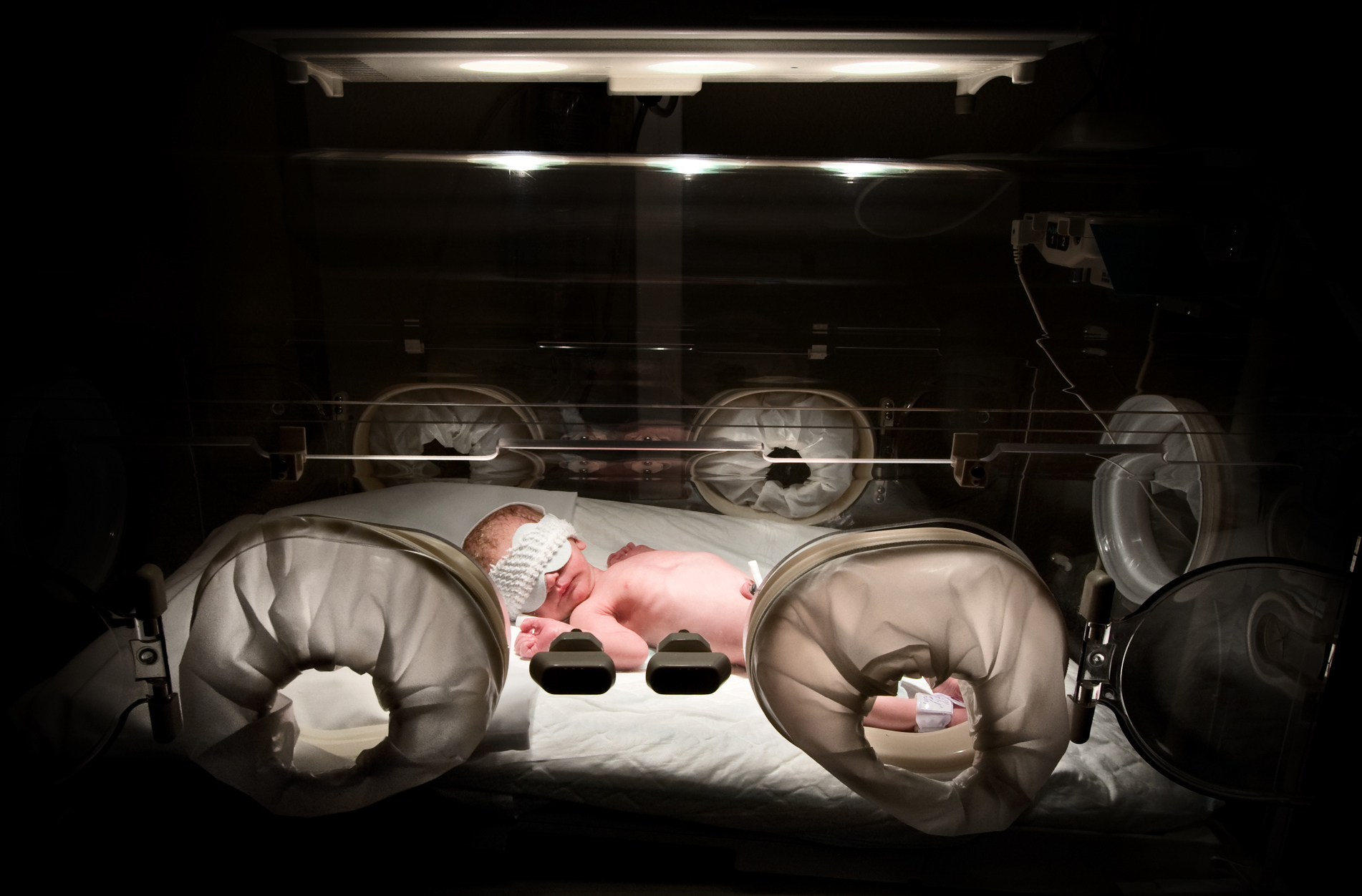 Stress, poverty and lack of  health care can lead to premature birth. Rates remain stubbornly high in many states. (inakiantonana/Getty Images)