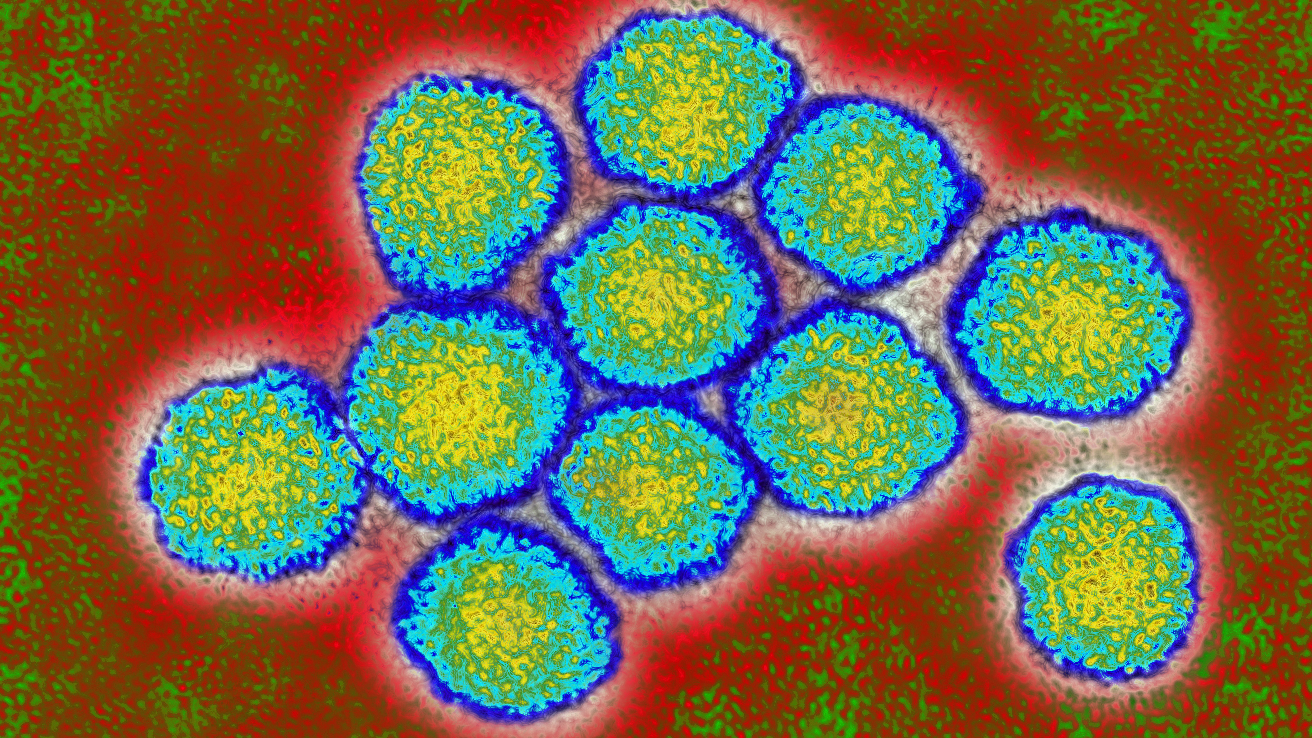 The initial test for hepatitis C is an inexpensive blood test to check for antibodies that indicate the person's been exposed to the virus. If that antibody test is positive, a second test is done to see if the virus is circulating in the bloodstream — a sign there's an infection that needs treatment. (UIG/Getty Images)