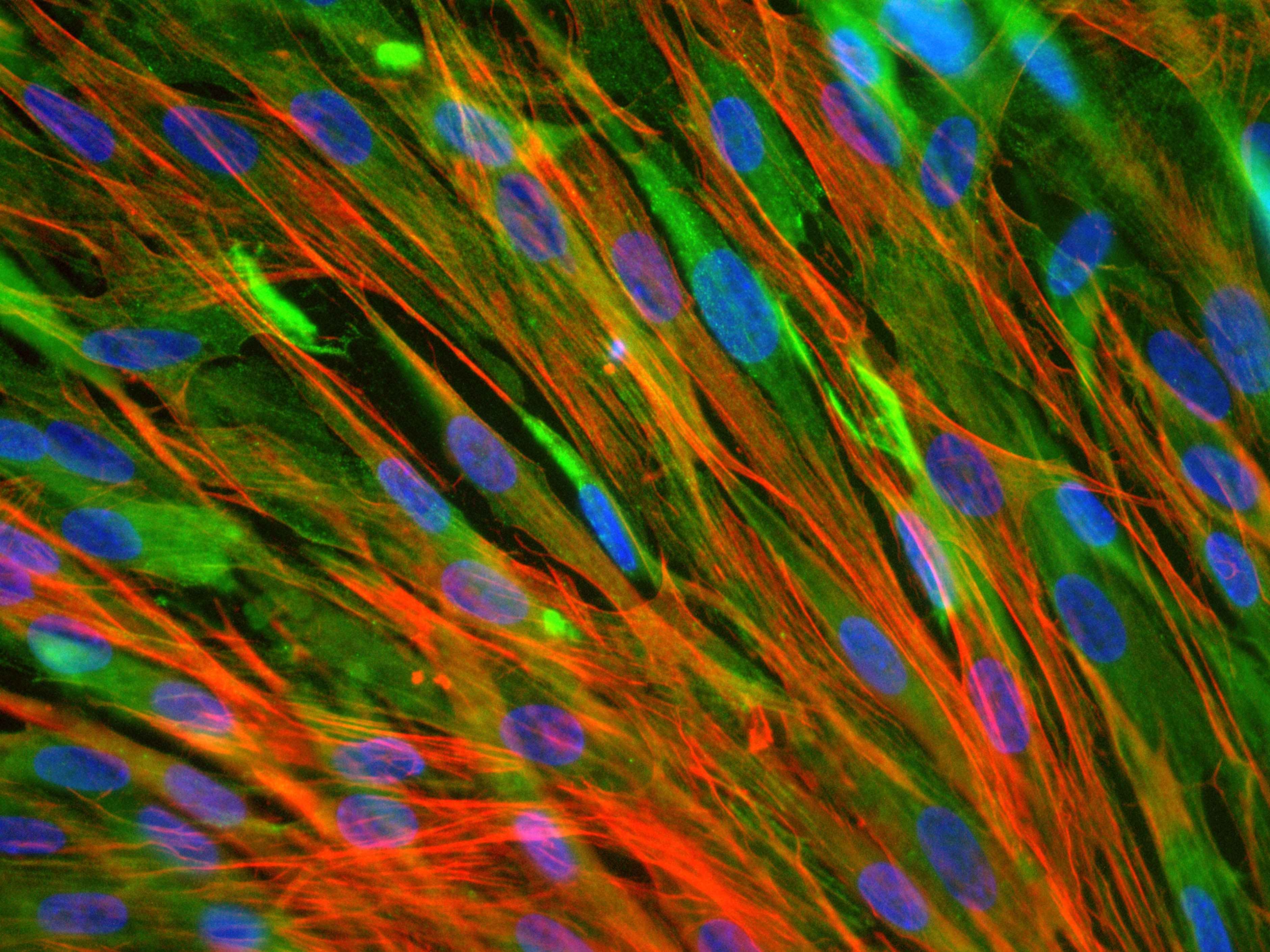 Muscles May Preserve A Shortcut To Restore Lost Strength | NCPR News