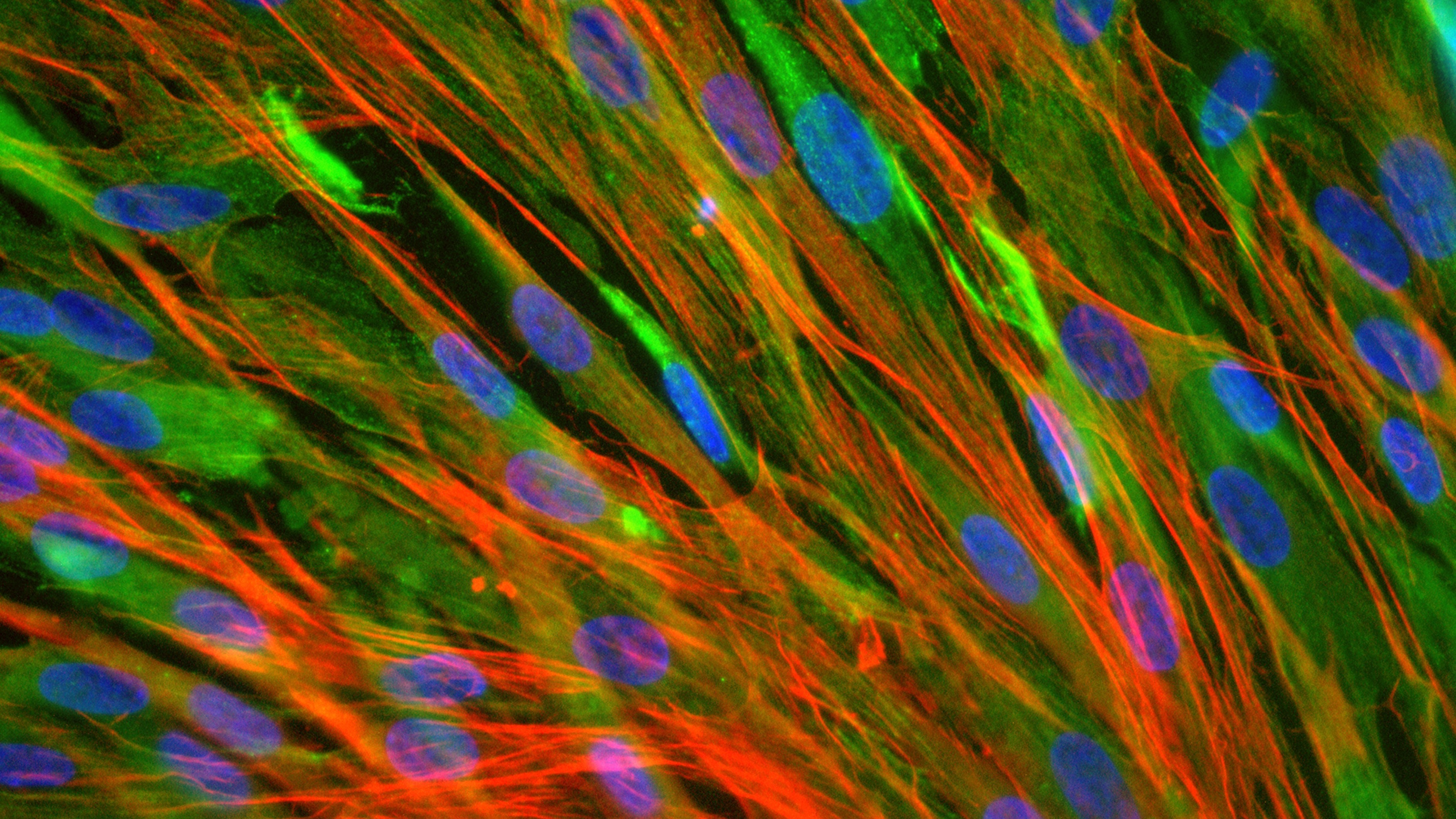Extra Nuclei Help Muscle Cells Regain Past Strength Shots Health