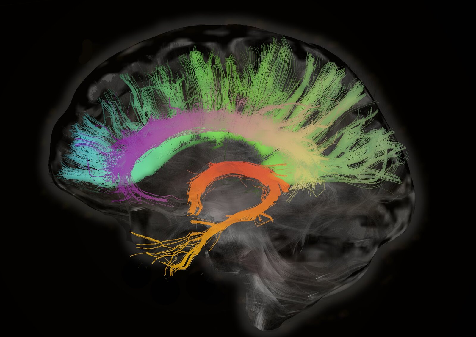 brainscan-2_custom-d29fbebf52a0e35783b1d