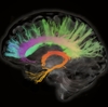 Scans Show Female Brains Remain Youthful As Male Brains Wind Down