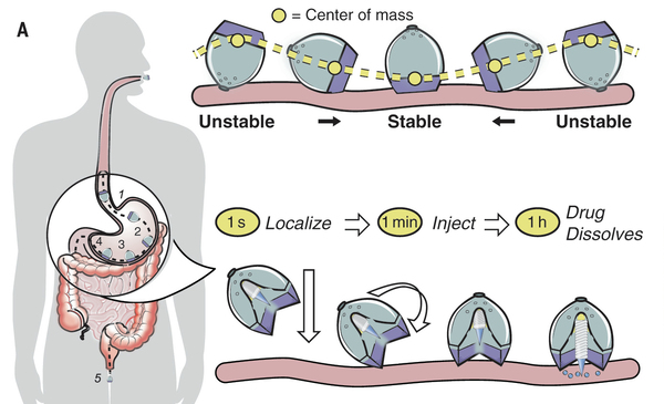 The self-righting capsule orients itself inside the stomach and ejects a tiny dart of solid insulin that's about a quarter of an inch long.