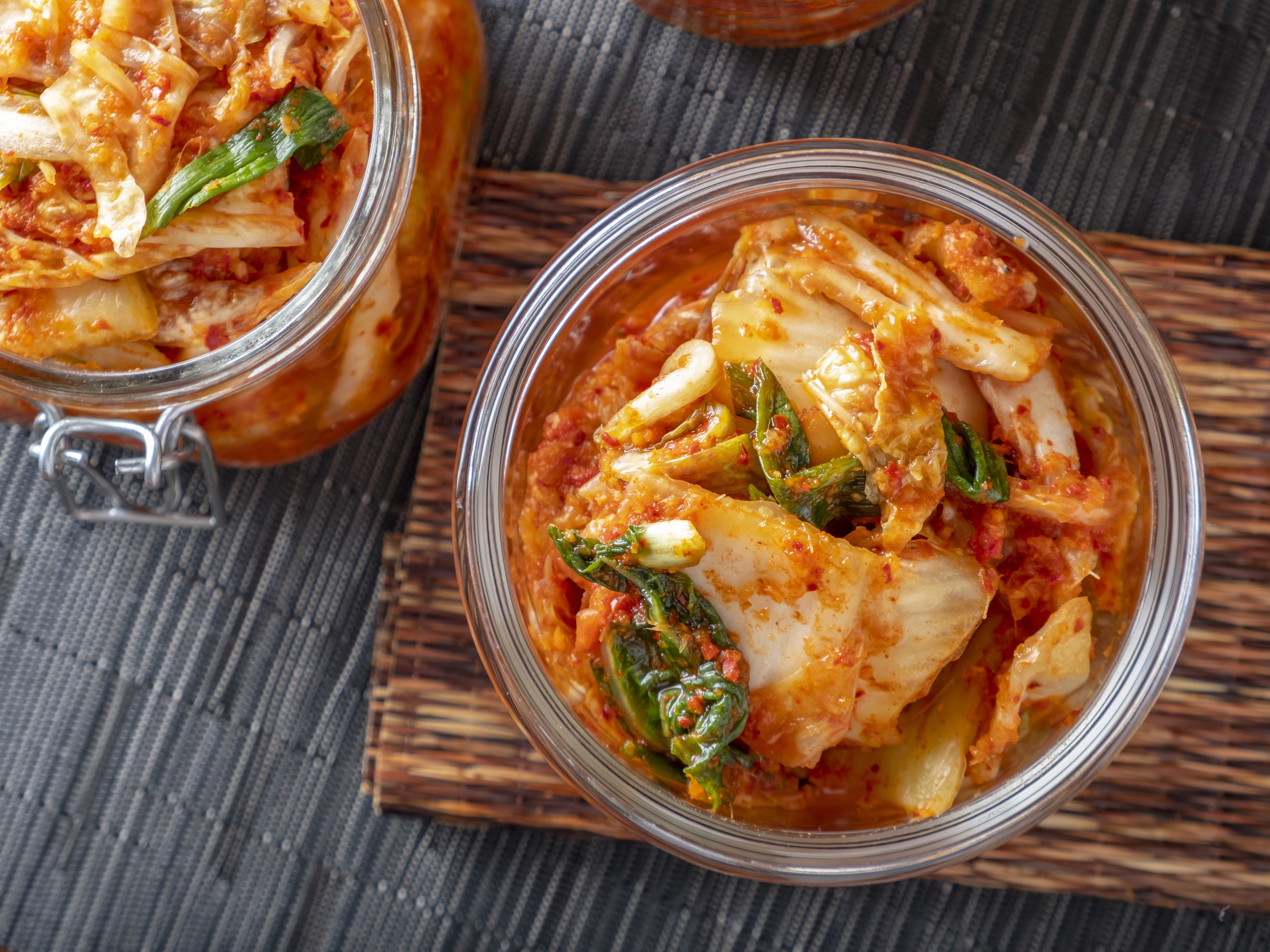 'Cultured': A Look At How Foods Can Help The Microbes Inside Us Thrive