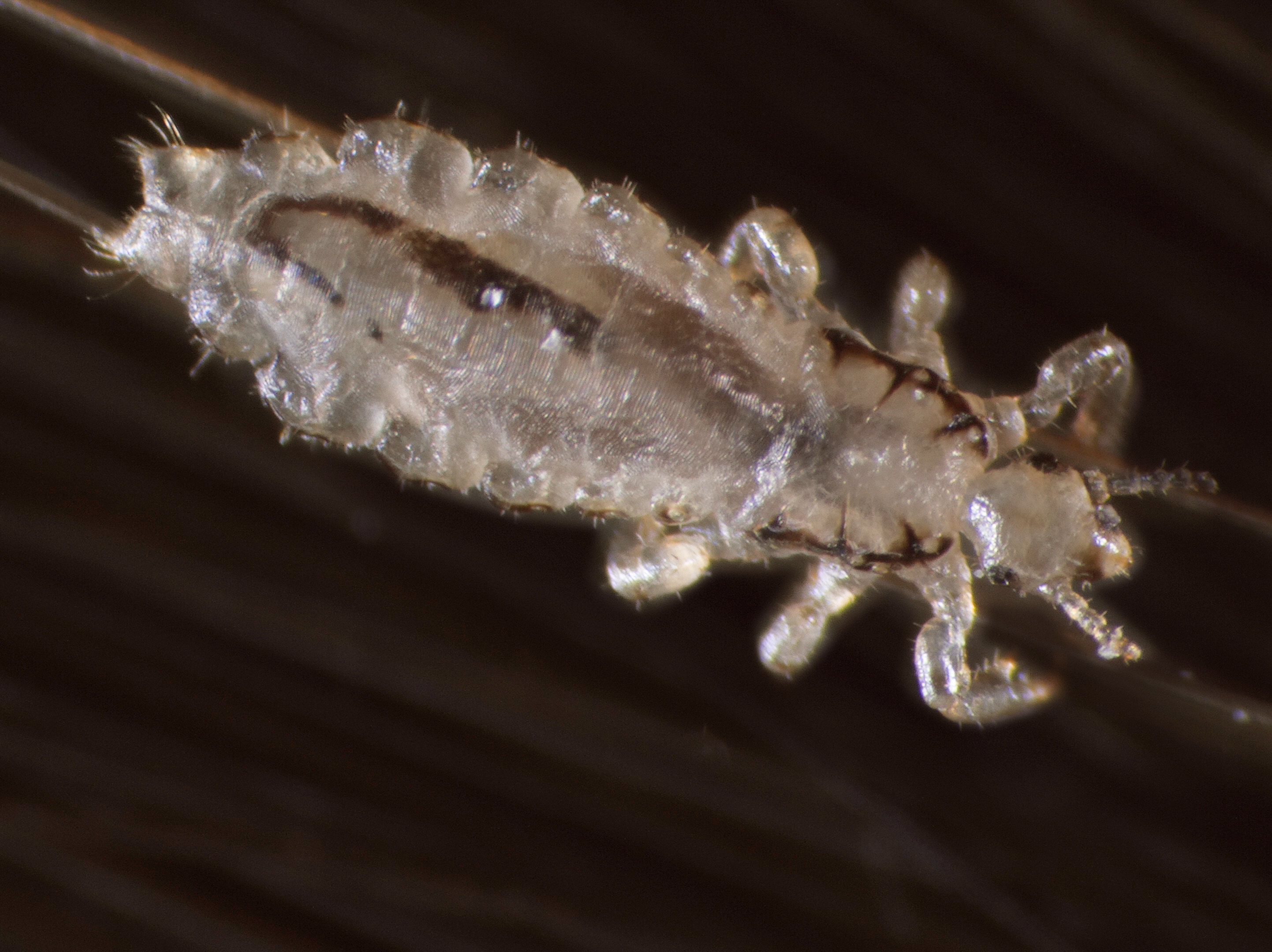 VIDEO Head Lice Up Close, And All Too Personal NCPR News