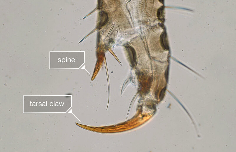 Video Secrets Of Head Lice And How To Beat Them Shots Health