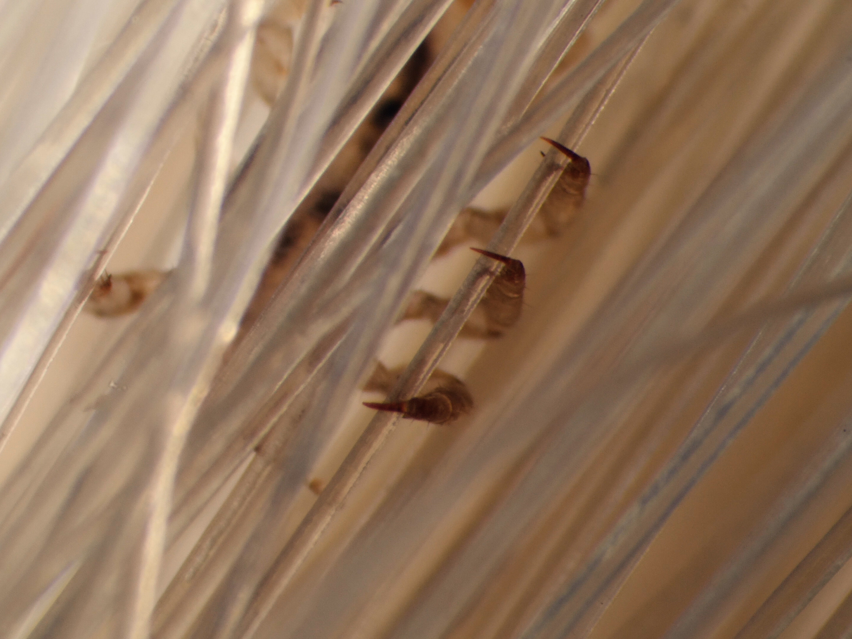 VIDEO Head Lice Up Close, And All Too Personal NCPR News