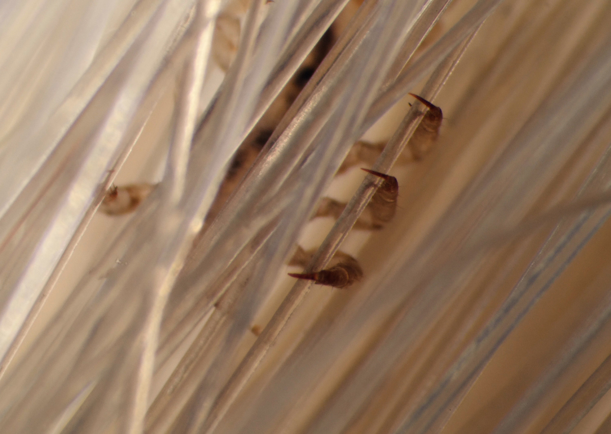 VIDEO Secrets Of Head Lice, And How To Beat Them Shots Health News