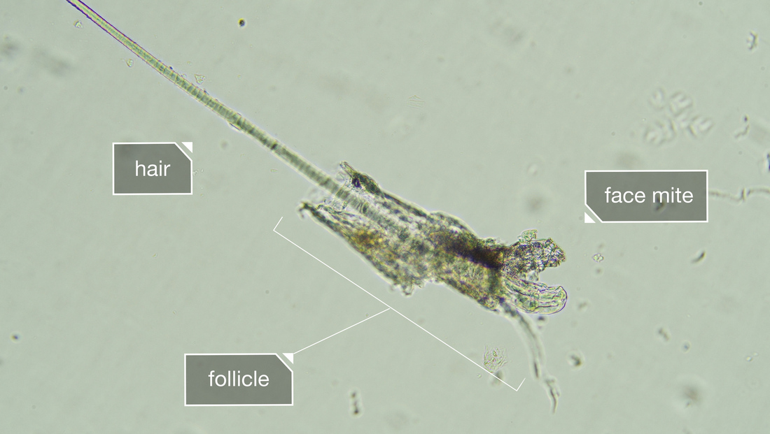 Face Mites They Really Grow On You Shots Health News NPR