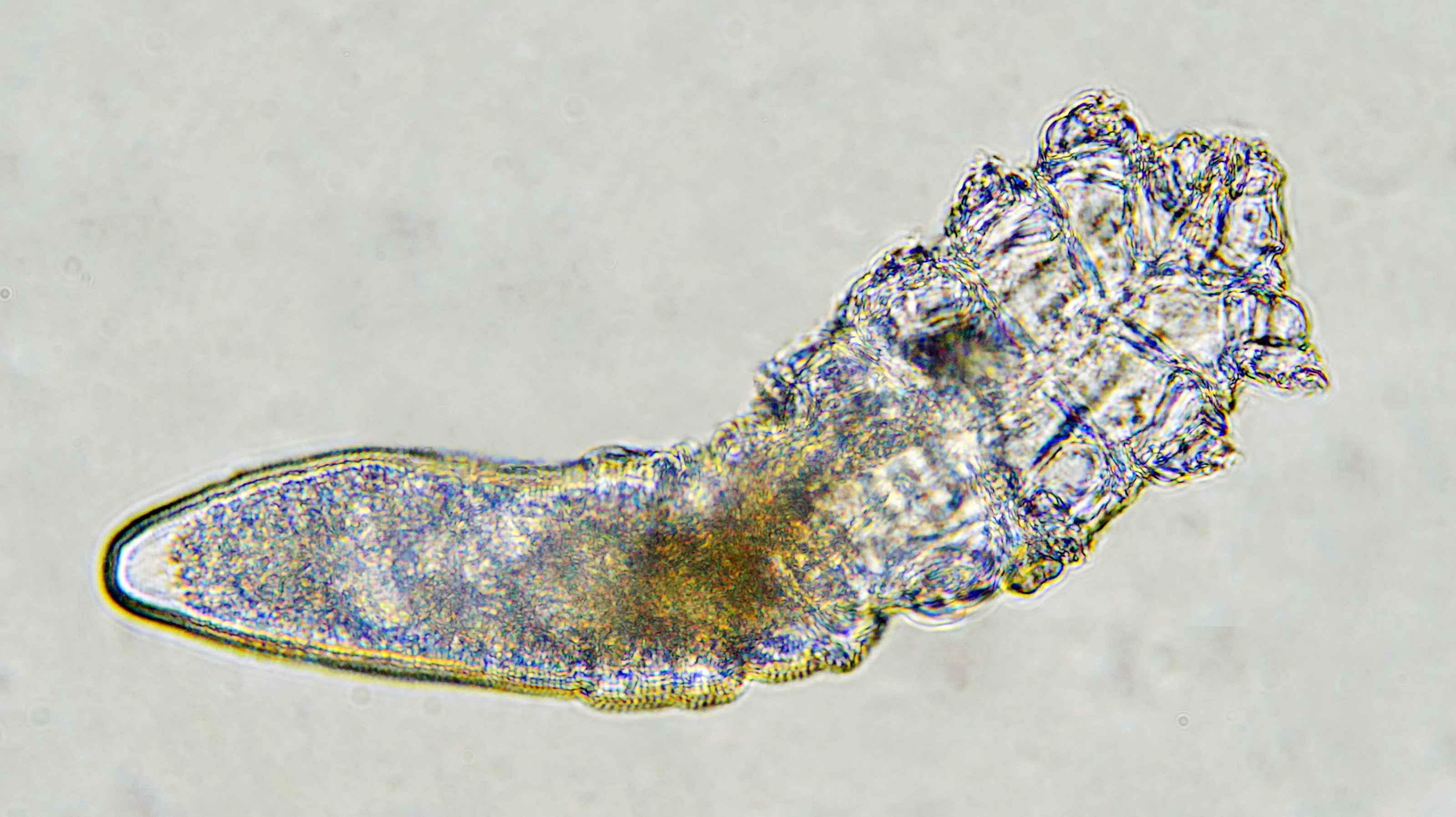 Meet The Mites That Live On Your Face NCPR News