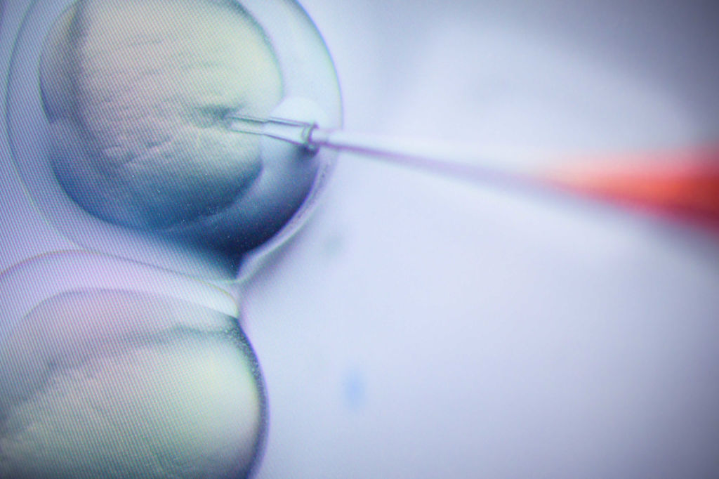CRISPR technology already allows scientists to make very precise modifications to DNA, and it could revolutionize how doctors prevent and treat many diseases. But using it to create gene-edited babies is still widely considered unethical. (picture alliance via Getty Images)