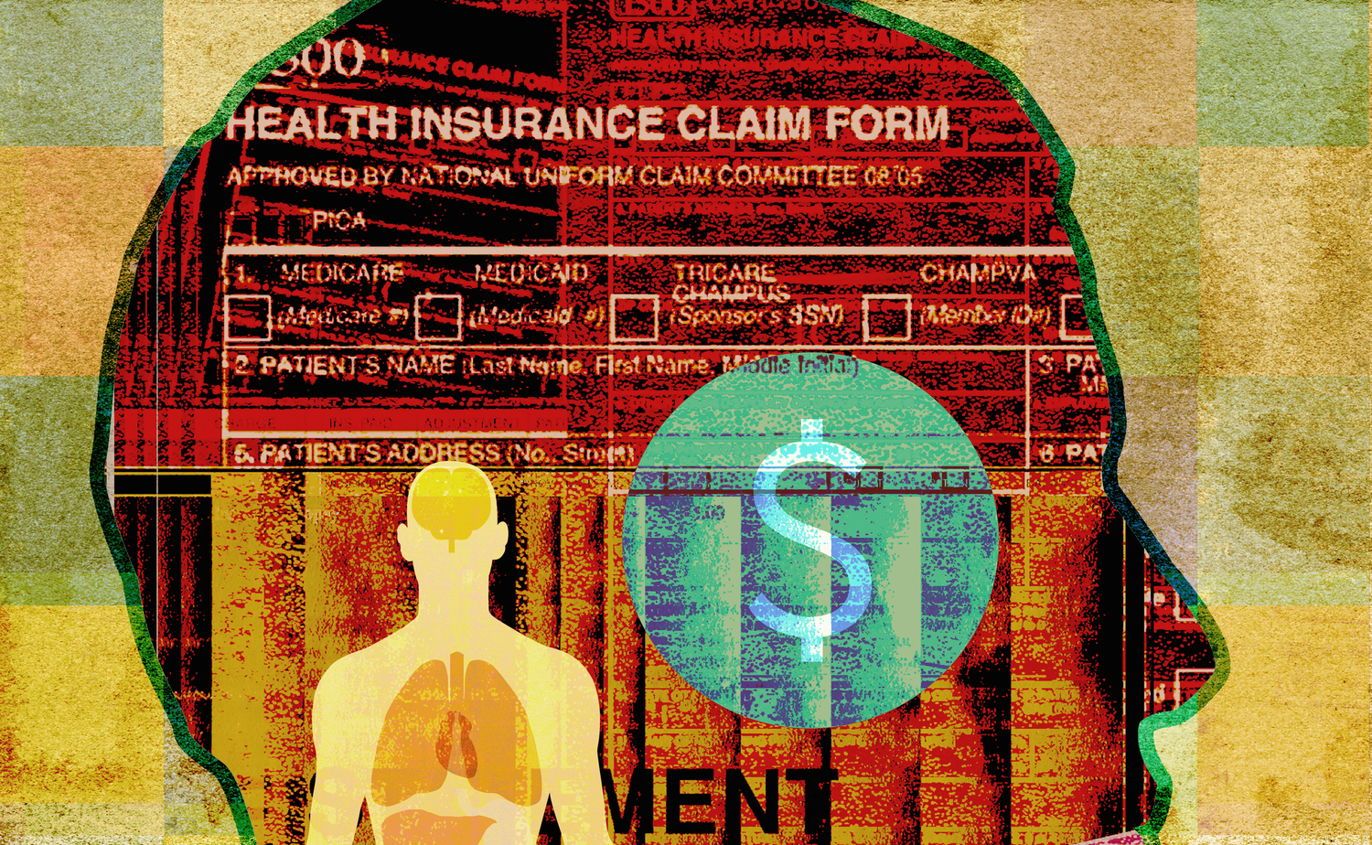 Medicare Advantage plans, administered by private insurance companies under contract with Medicare, treat more than 22 million seniors — more than 1 in 3 people on Medicare. (Ikon Images/Getty Images)