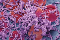 Bacteria (purple) in the bloodstream can trigger sepsis, a life-threatening illness.