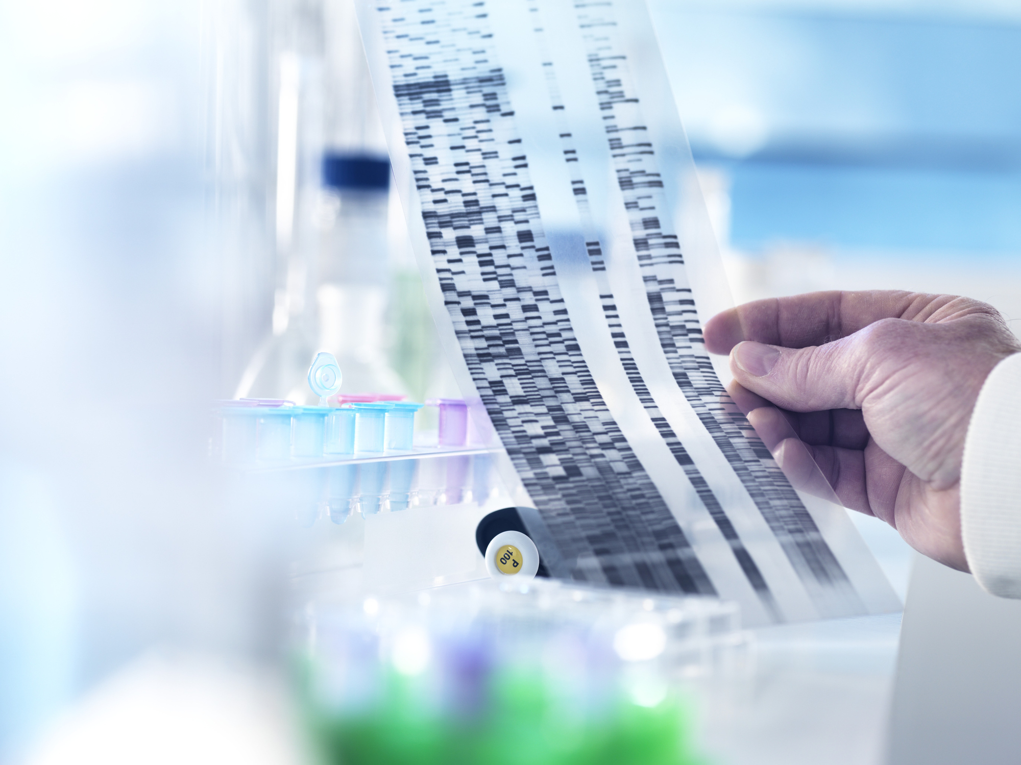 Overall in medical research, the proportion of participants with non-European ancestry is only about 20 percent, says Columbia University bioethicist Sandra Soo-Jin Lee. And that's a problem. (Science Photo Library/Getty Images)