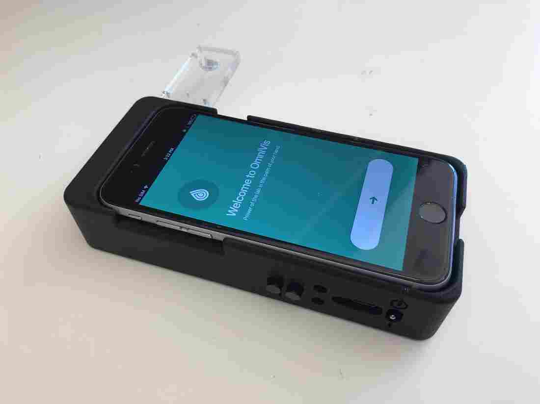 Water is collected in a plastic test kit, then placed in this hardware device (which also contains a smartphone) for a series of procedures to determine whether the bacterium that causes cholera is present.