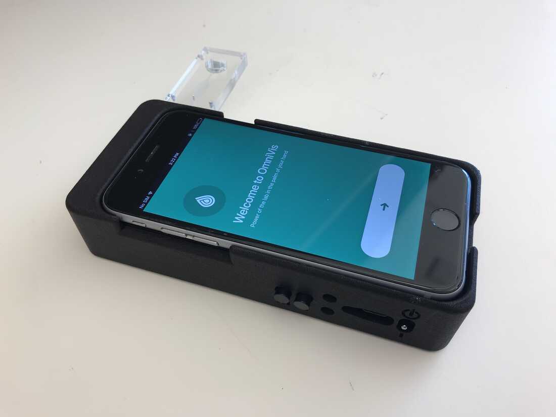 Water is collected in a plastic test kit, then placed in this hardware device (which also contains a smartphone) for a series of procedures to determine whether the bacterium that causes cholera is present.