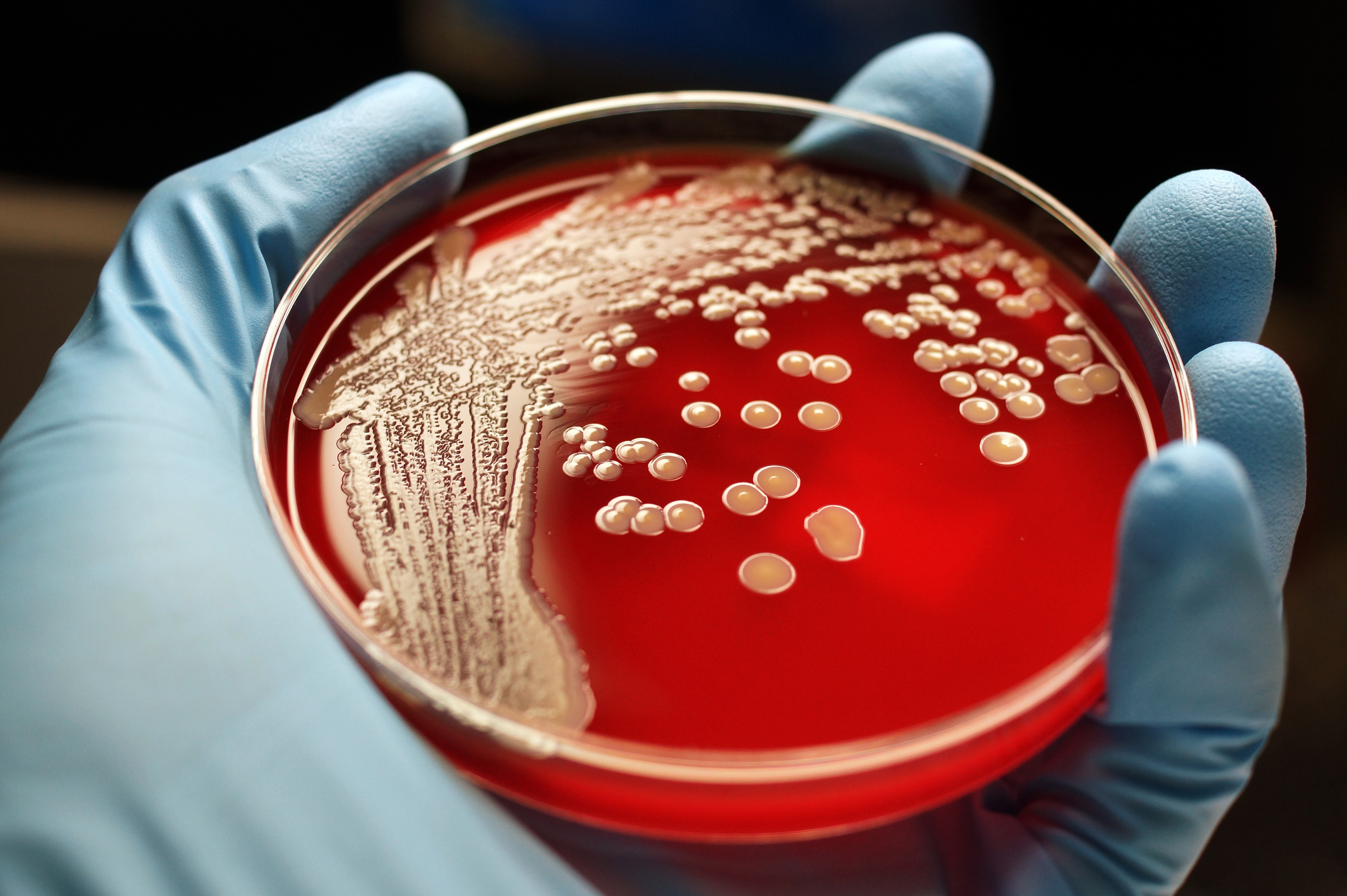 Scientists are exploring new drugs that can fight antibiotic-resistant bacteria such as MRSA. (Getty Images)