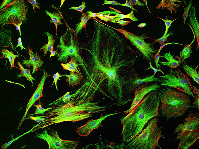 Brain Cell Development Differs In Those >> Why Cells In Mouse Brains Fall Short As Models For Human Brain Cell Development Differs In Those >> Why Cells In Mouse Brains Fall Short As Models For Human