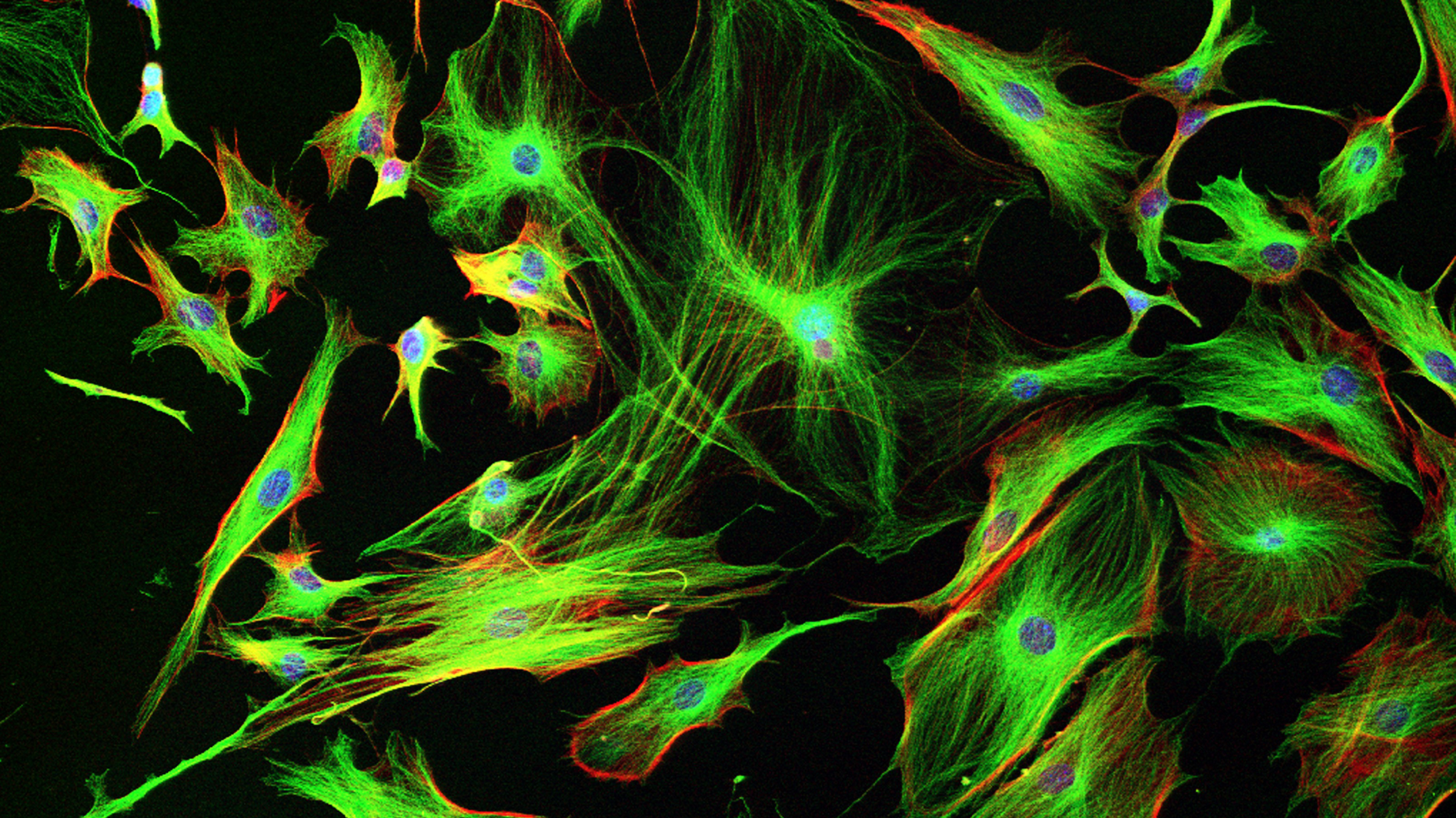 Astrocyte cells like these from the brain of a mouse may differ subtly from those in a human brain.