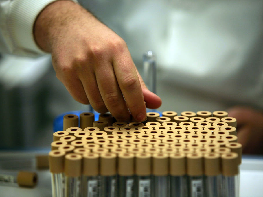 Researchers looked for genetic variants linked to sexual behavior in new genetic research that analyzed DNA from donated blood samples from nearly half a million middle-aged people from Britain who participated in a project called UK Biobank. (Getty Images)