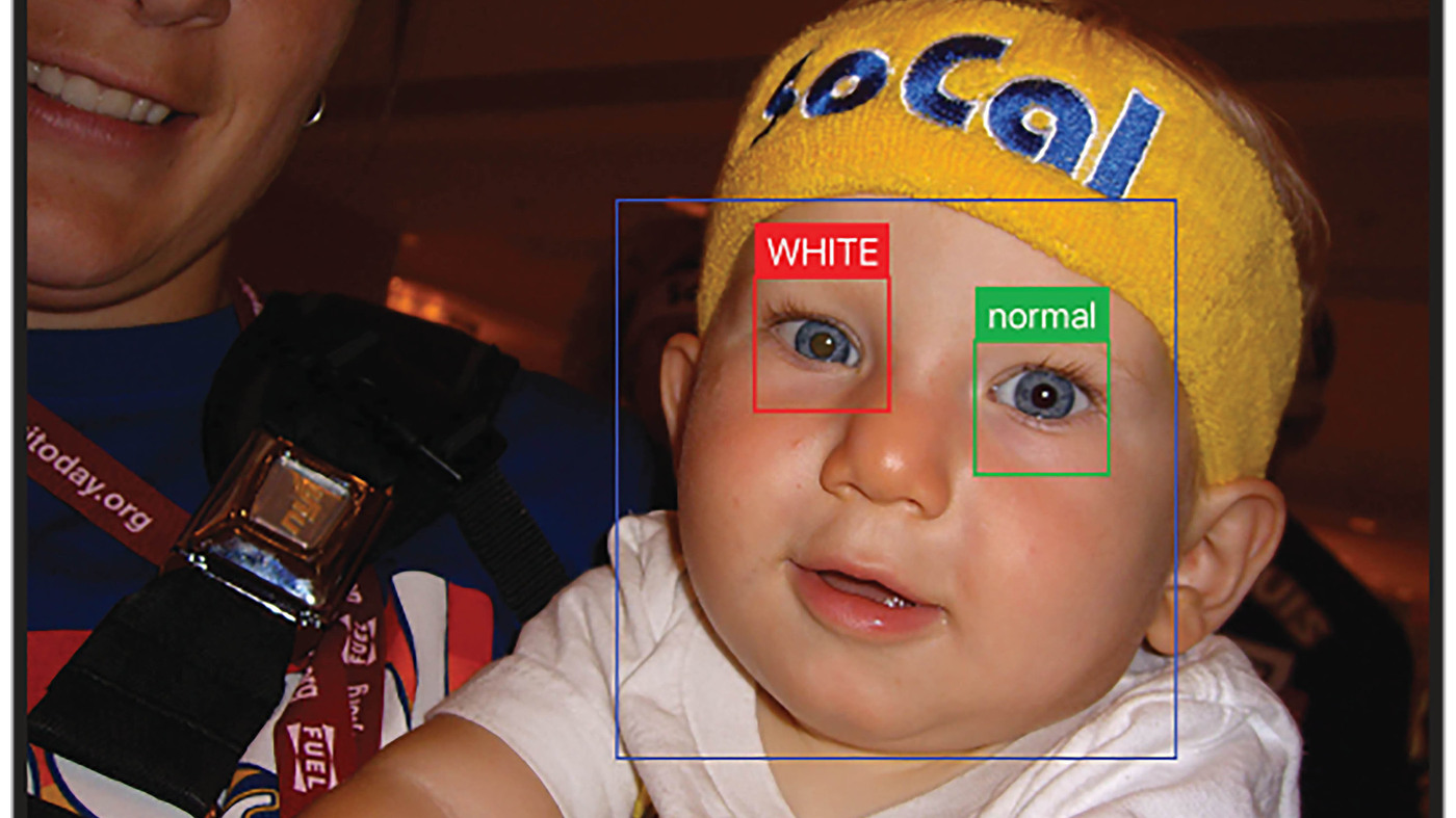 An App That Can Catch Early Signs Of Eye Disease In A Flash