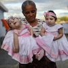 Zika: Researchers Are Learning More About The Long-Term Consequences For Children