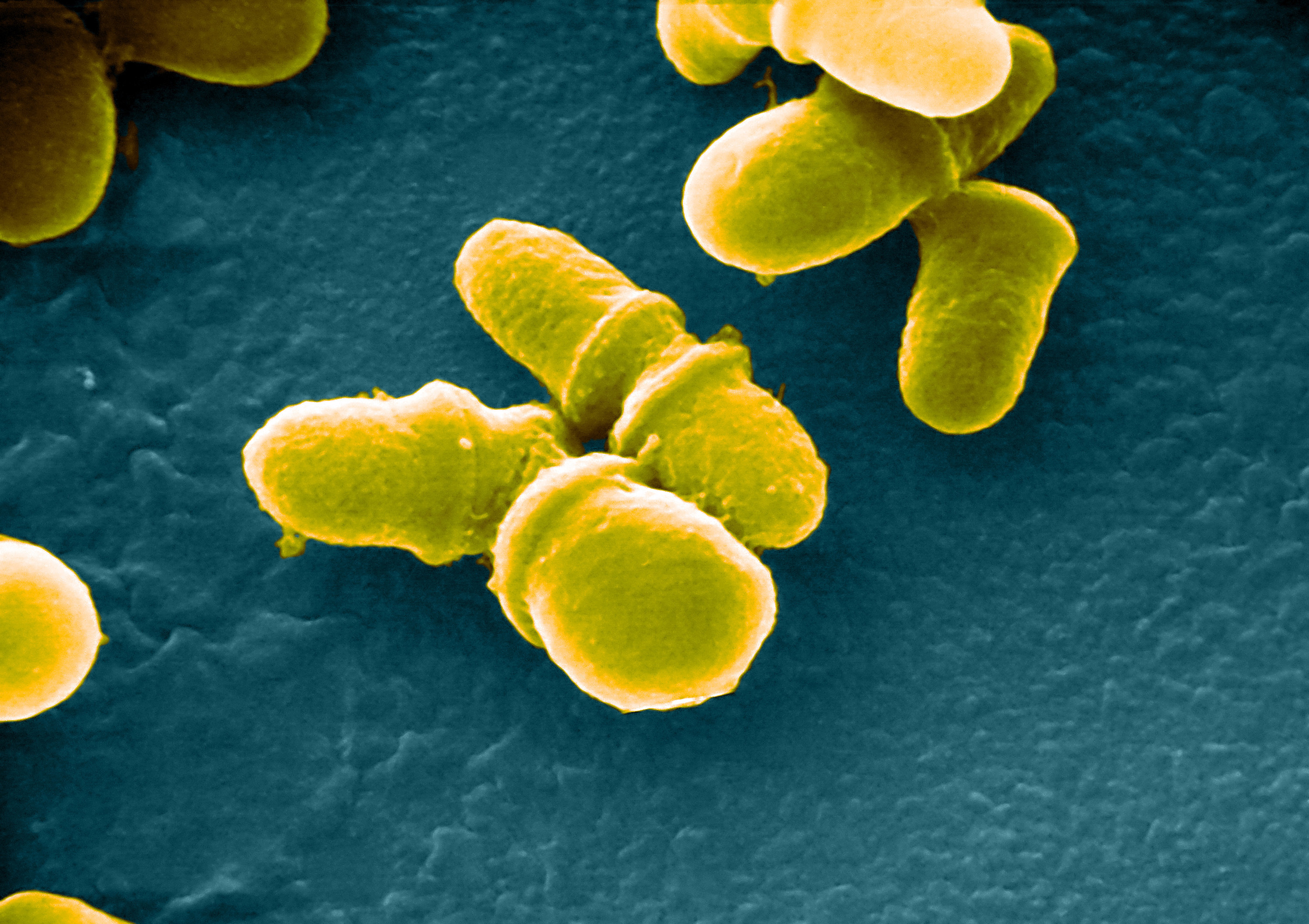 <em>Malassezia</em> is a genus of fungi naturally found on the skin surfaces of many animals, including humans. The researchers found it in urban apartments, although some strains have been known to cause infections in hospitals. (Science Source)