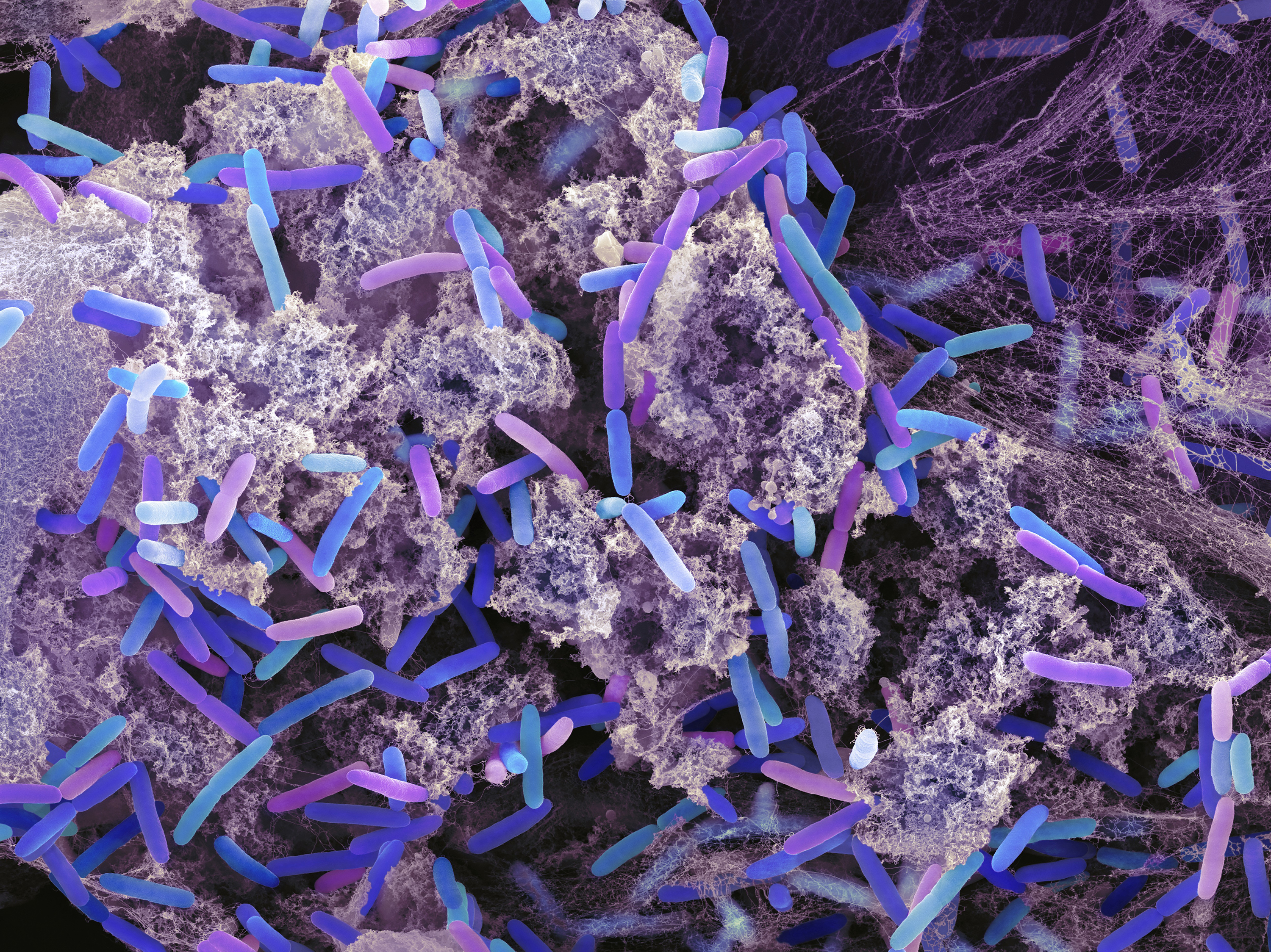 <em>Pseudomonas aeruginosa </em>bacteria — rod-shaped bacteria in this tinted, scanning electron microscope image — are found in soil, water and as normal flora in the human intestine. But they can cause serious wound, lung, skin and urinary tract infections, and many <em>pseudomonas</em> strains are drug-resistant. (Science Source)
