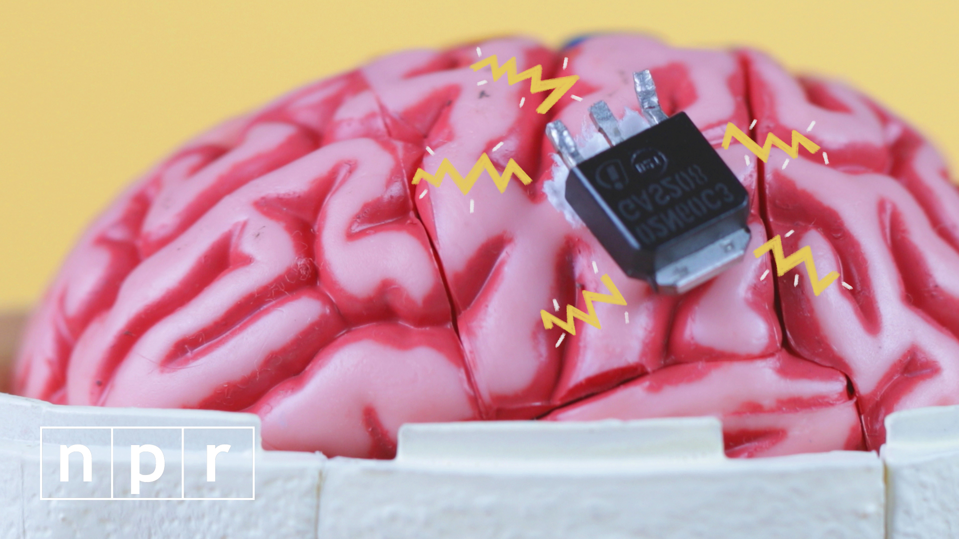 VIDEO: Elon Musk's Next Quest Is A Mind-Machine Meld. Let's Consider The Implications