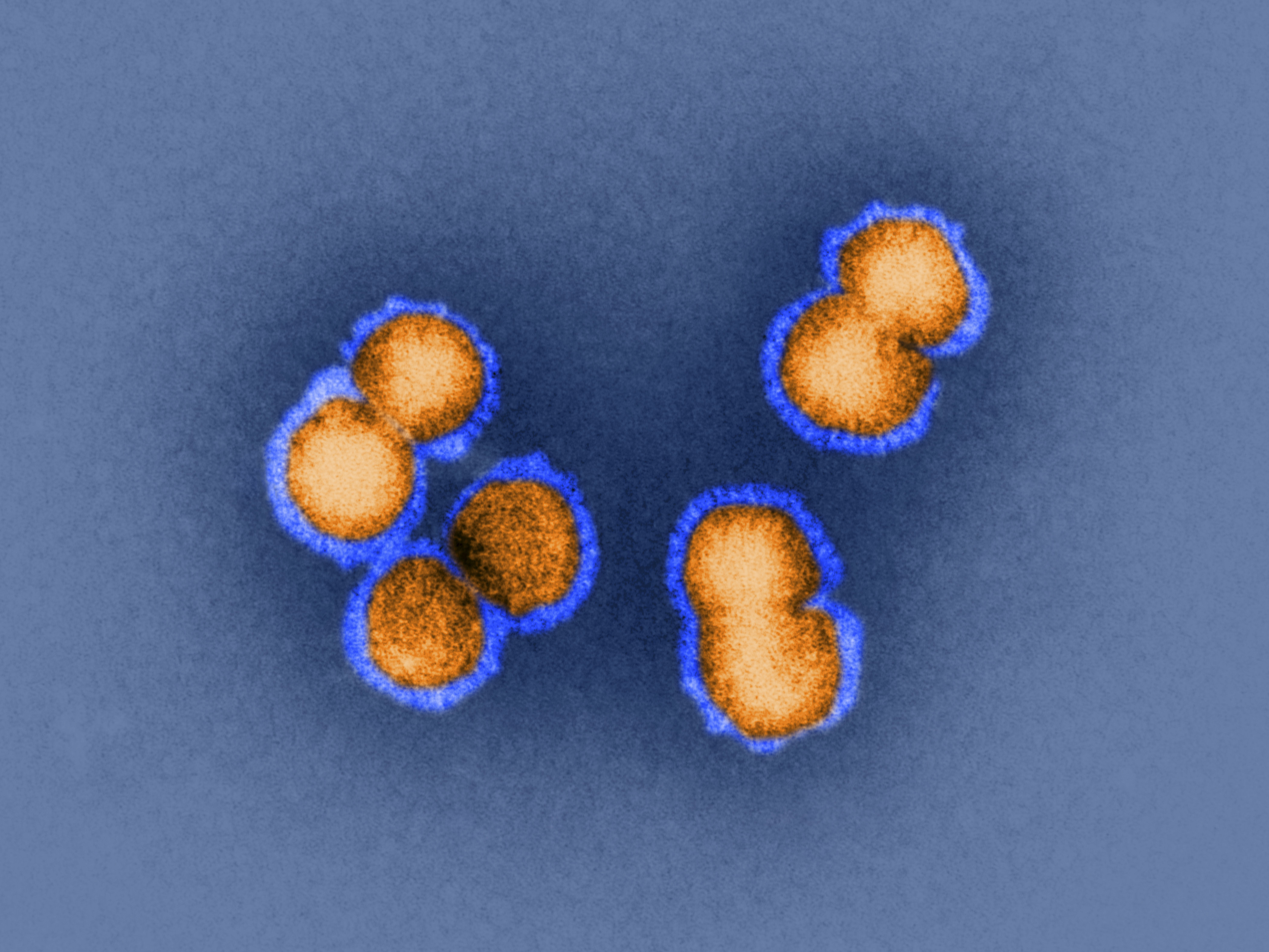 H5N1 bird flu virus is the sort of virus under discussion this week in Bethesda, Md. How animal viruses can acquire the ability to jump into humans and quickly move from person to person is exactly the question that some researchers are trying to answer by manipulating pathogens in the lab. (Dr. Klaus Boller/Science Source)