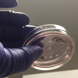 Scientists Find Imperfections In 'Minibrains' That Raise Questions For Research