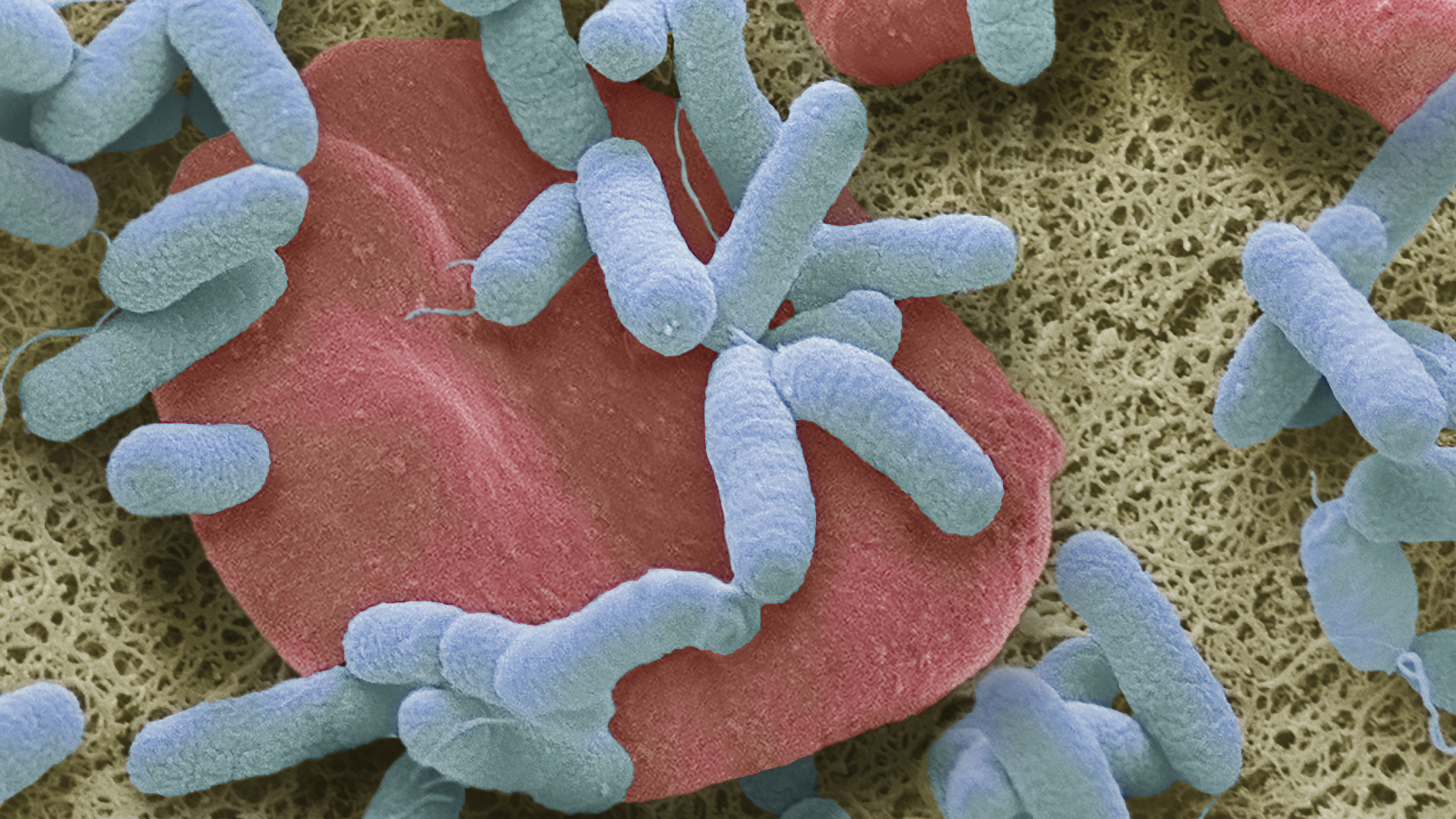 Sepsis Is A Global Killer Can Vitamin C Be The Cure Short Wave NPR
