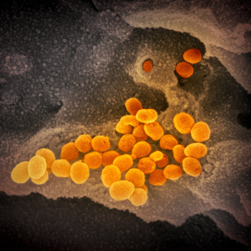 This image from a scanning electron microscope shows, in orange, the coronavirus that causes the disease COVID-19. The virus was isolated from a patient in the U.S. and is seen here emerging from the surface of cells — in gray — cultured in the lab. NIAID-RML