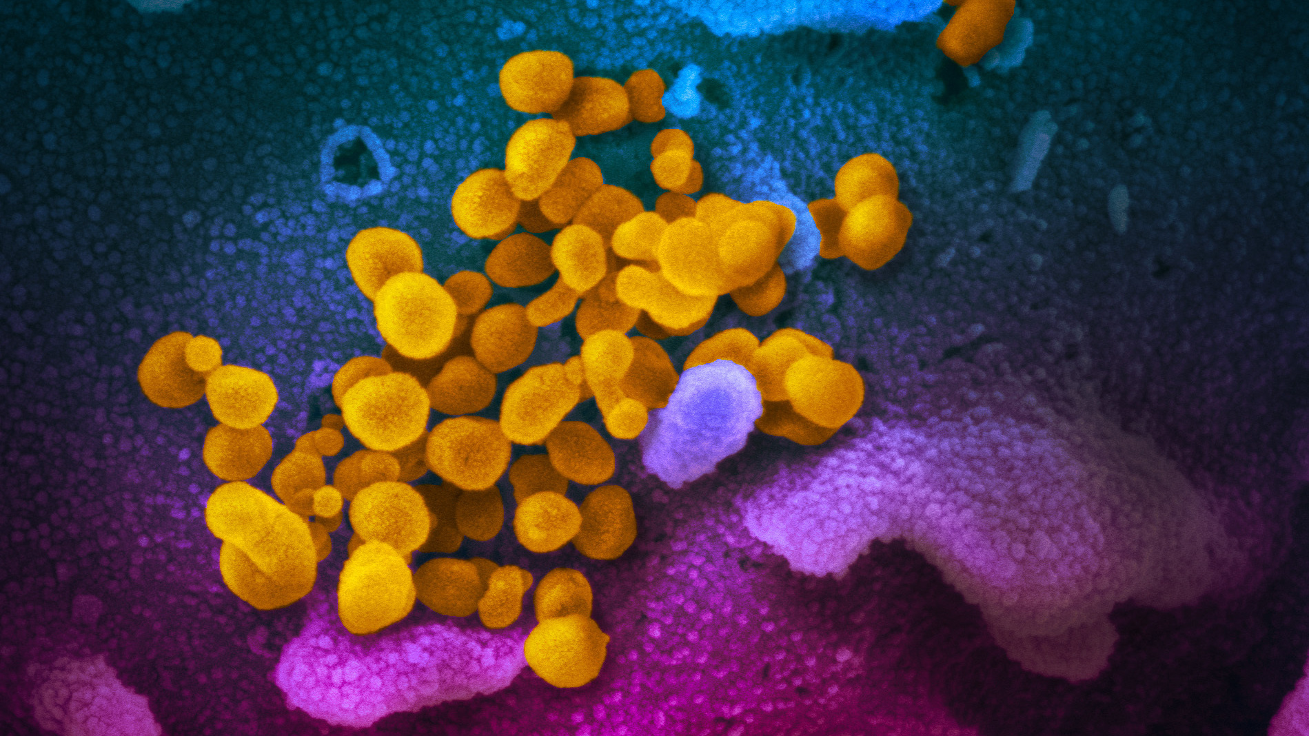 絵画　COVID IMAGES: What New Coronavirus Looks Like Under The Microscope