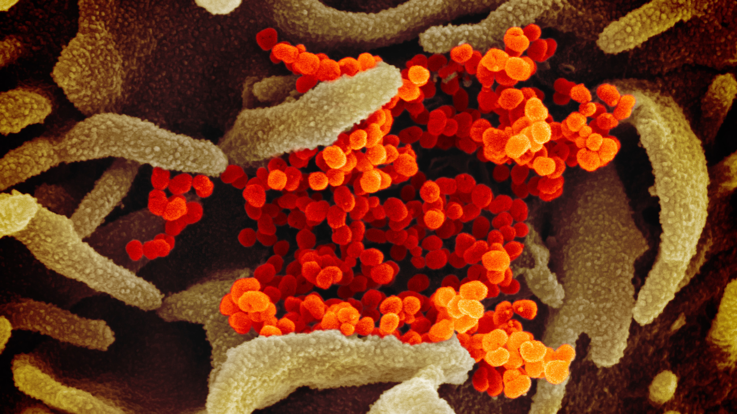 絵画　COVID IMAGES: What New Coronavirus Looks Like Under The Microscope