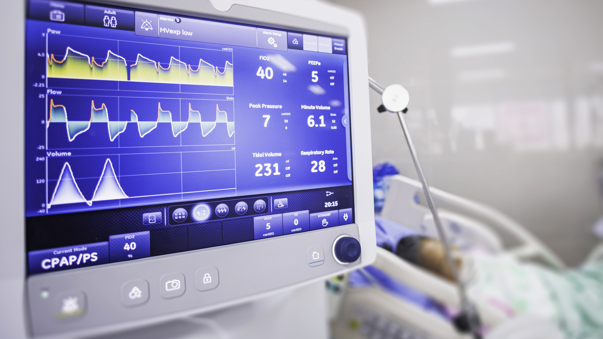 Ventilator Shortages Possible As COVID-19 Spreads In U.S. : Shots ...