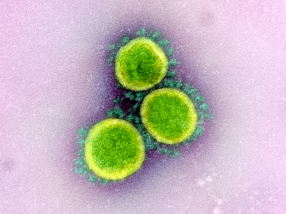 Transmission electron micrograph of particles of SARS-CoV-2 — the coronavirus that causes COVID-19. (NIAID/Flickr)