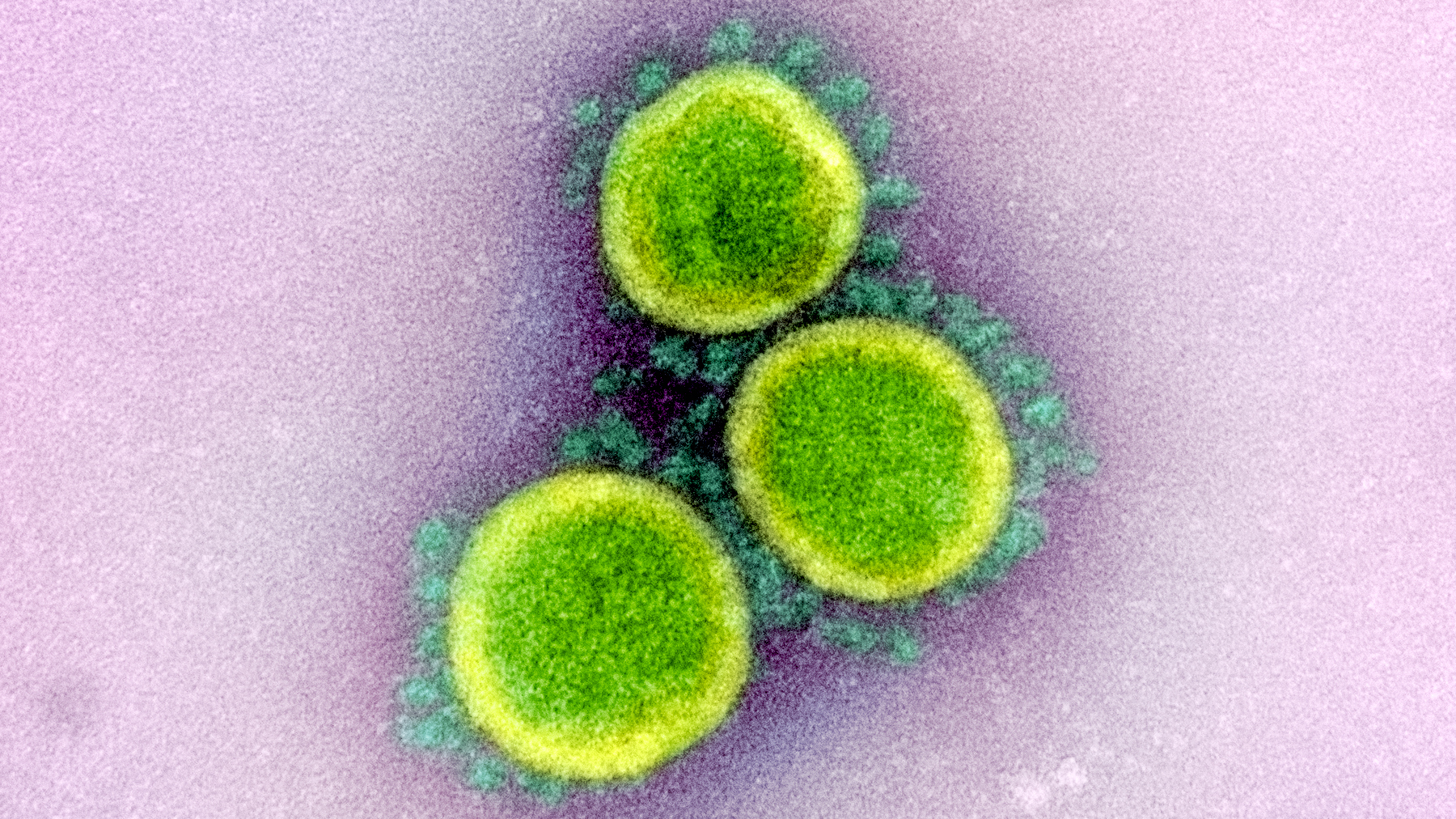 Transmission electron micrograph of particles of SARS-CoV-2 — the coronavirus that causes COVID-19.