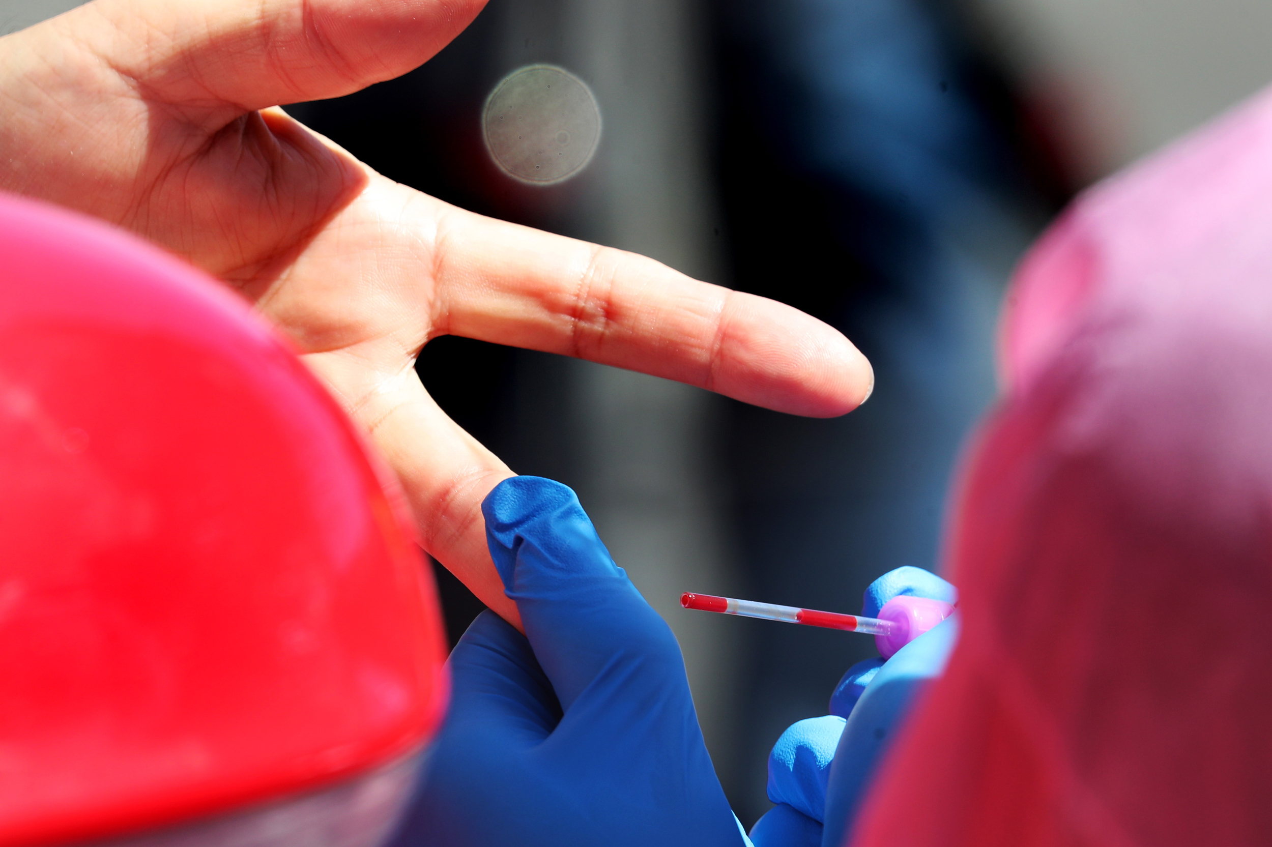Stanford medical student Thomas Koehnkz takes a blood sample from Alan Wessel of Mountain View, Calif., for a coronavirus antibody study. (MediaNews Group/The Mercury News via Getty Images)