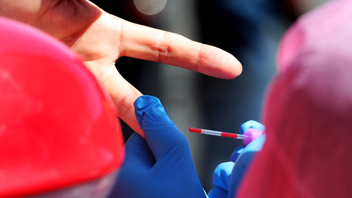 False Positives For Coronavirus Could Hamper Antibody Tests : Shots - Health  News : NPR