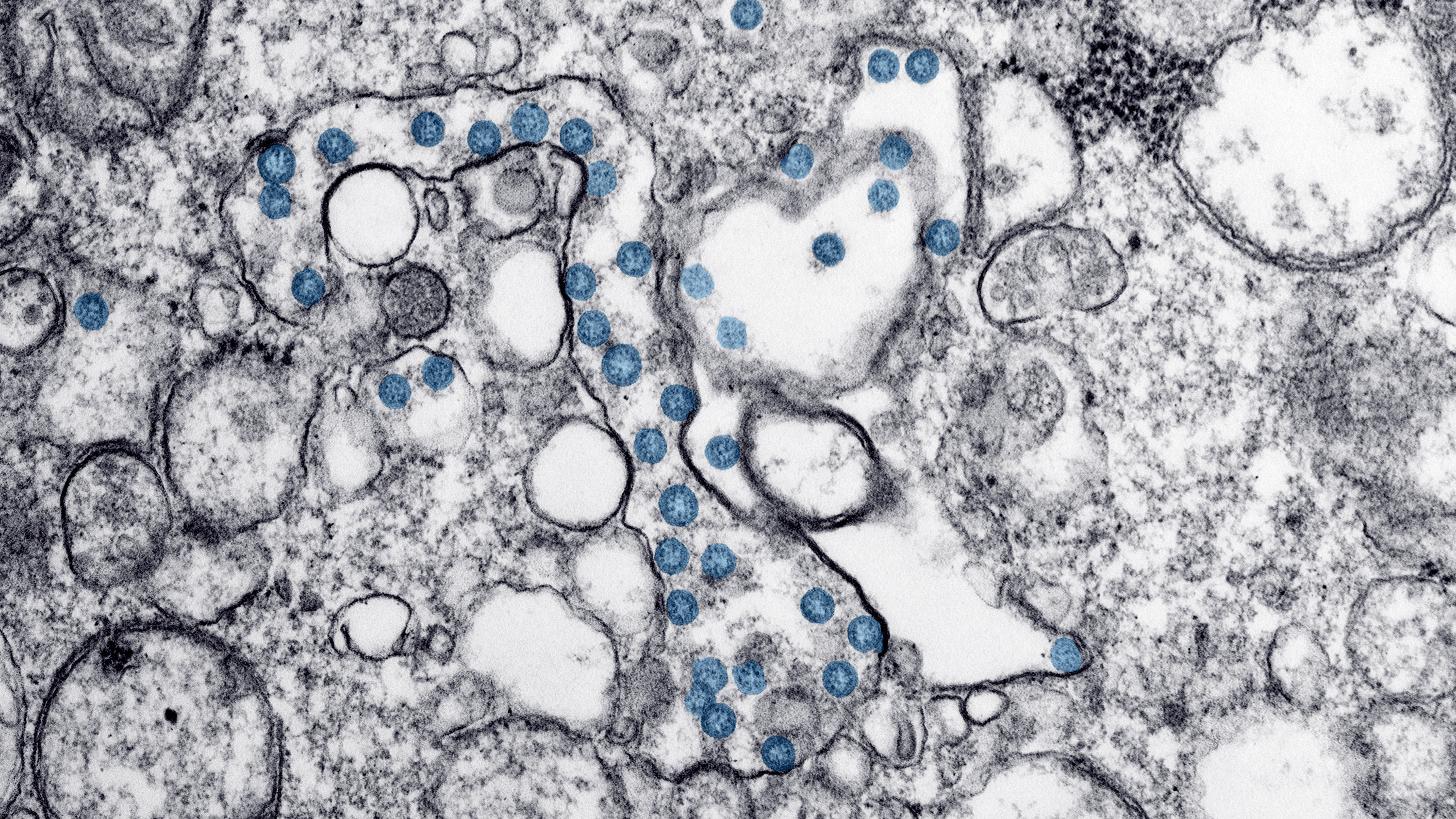 This 2020 electron microscope image made available by the U.S. Centers for Disease Control and Prevention shows the spherical particles of the new coronavirus, colorized blue. New York is planning a major effort to test the population for antibodies for the coronavirus as a key to deciding whether to reopen the economy.