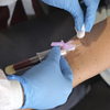 FDA Cracks Down On Antibody Tests For Coronavirus