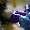 Despite Early Warnings, U.S. Took Months To Expand Swab Production For COVID-19 Test