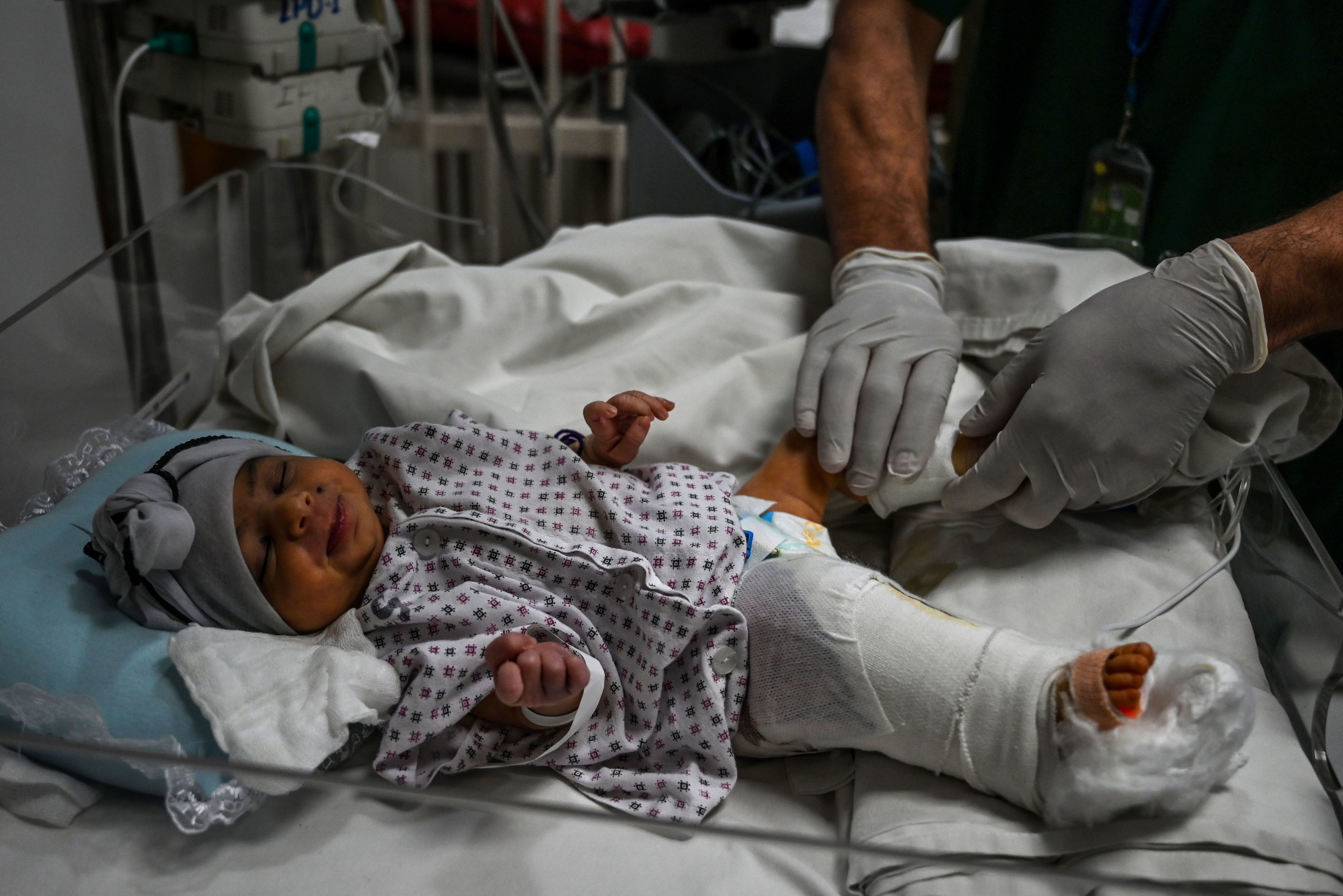 A newborn baby girl receives treatment for the gun wound in her right leg received during the attack on a maternity clinic in Kabul this week. The gunmen killed her mother. (AFP via Getty Images)