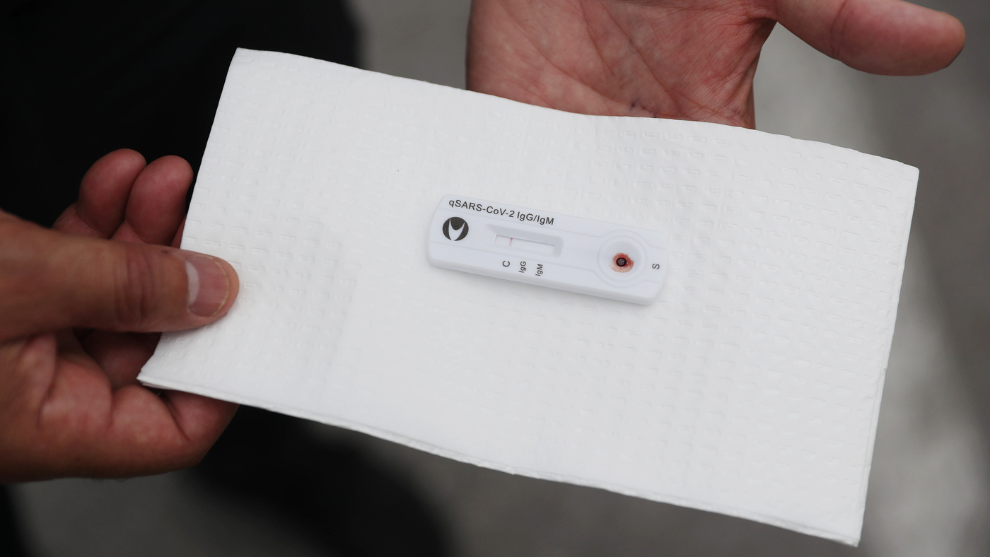 Testing For Coronavirus Antibodies Twice Can Reduce Errors : Shots - Health  News : NPR