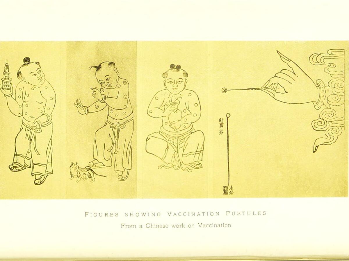 The origin of the vaccine can be traced back to smallpox inoculation in Imperial China.