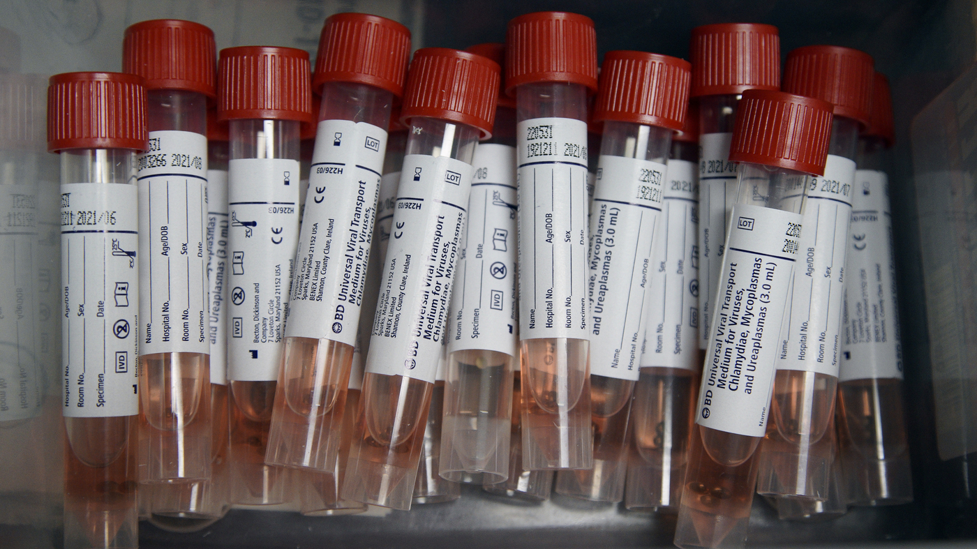 Pooling Coronavirus Tests Can ...