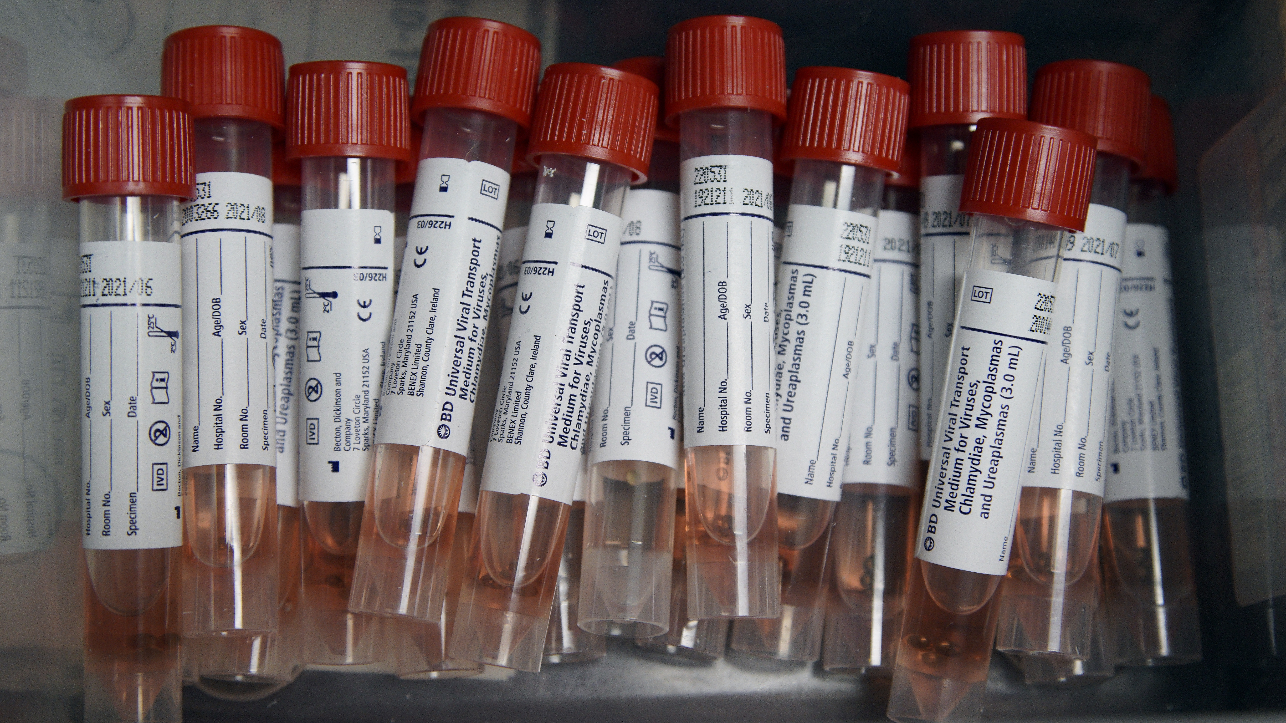 Specimens collected from multiple people can be combined into one batch to test for the coronavirus. A negative result would clear all the specimens.